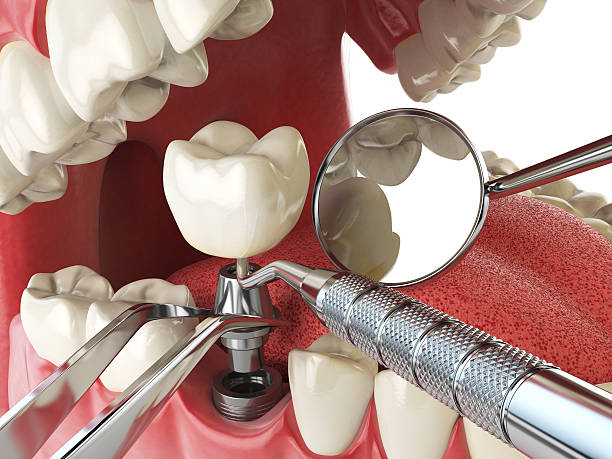 Best Cracked Tooth Emergency Dentist  in Cortland, NY